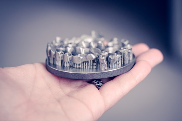 Metal Printed Dental Crowns