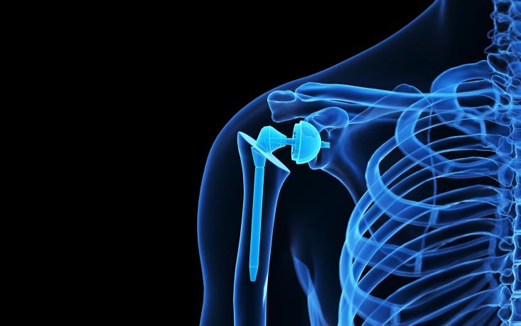 Medical implant