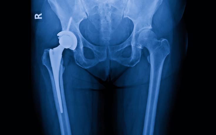 Medical implant