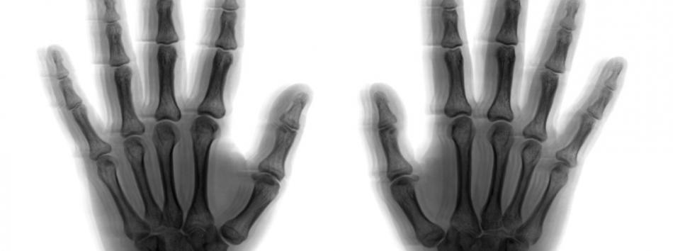 Hand arm vibration in wet blasting