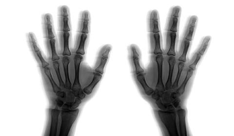 Hand Arm Vibration White Paper